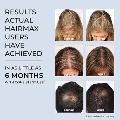 HairMax Ultima 9 Classic LaserComb (FDA Cleared) Hair Growth Device. Stimulates Hair Growth, Reverses Thinning, Regrows Denser, Fuller Hair. Targeted Hair Loss Treatment.