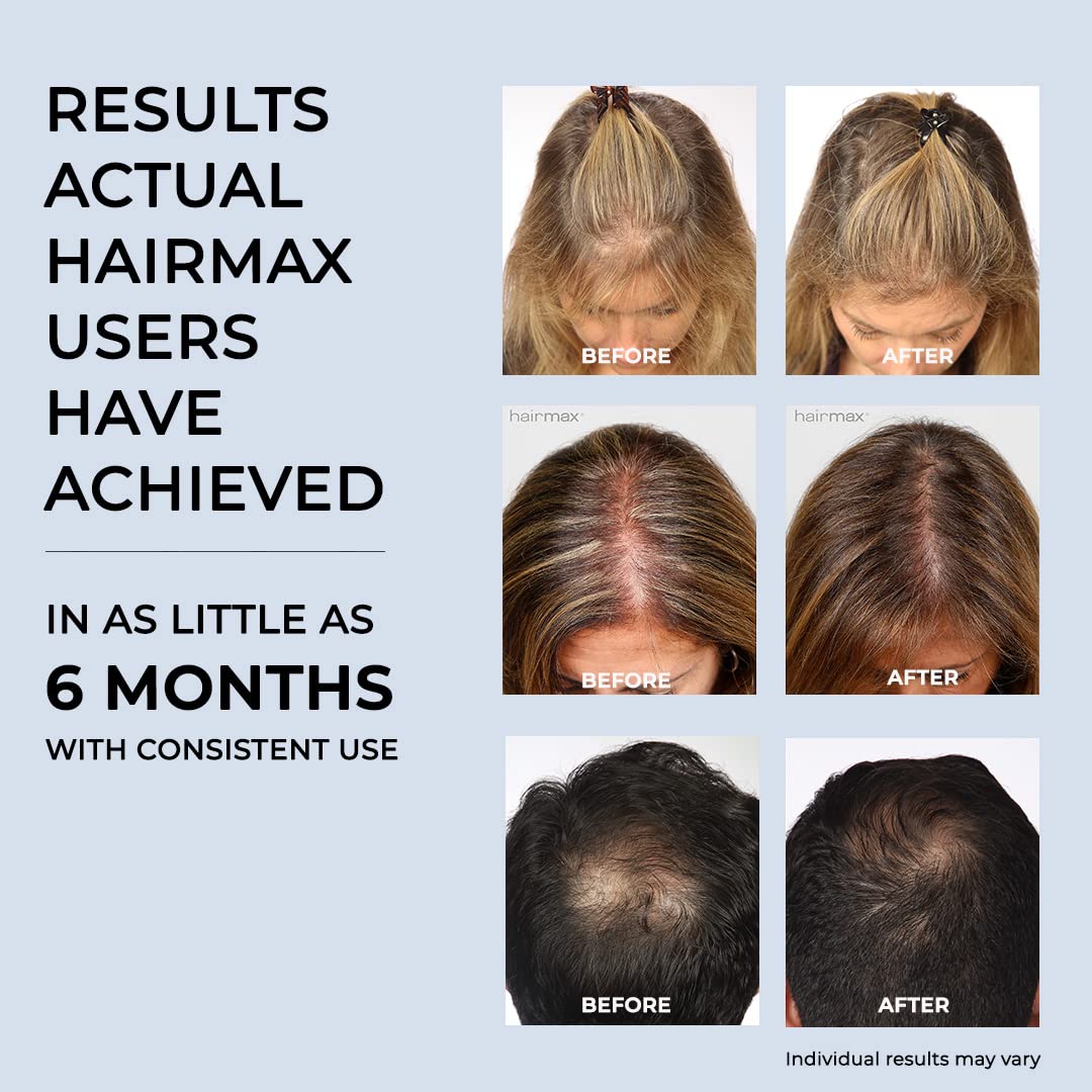 Hairmax Ultima 9 (FDA Cleared) Laser Hair Growth Comb, 100% Medical Grade Lasers (No LEDs), Laser Hair Growth Treatment for Men & Women, Thinning Hair Treatment for Women and Men, Denser & Fuller Hair, Spot or Full Scalp Coverage, Hair Growth Products to