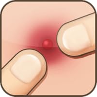 Pimple Popper (Ad Free - Kindle Tablet Edition)