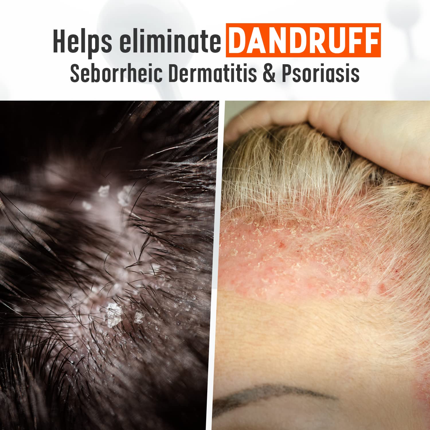 Medicasp Coal Tar Gel Dandruff Shampoo to Treat Seborrheic Dermatitis Psoriasis, 6 Ounce (Pack of 2), Brown (GEN64593)