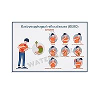 Gastroesophageal Reflux Disease (GERD) Symptoms Poster Hospital Clinic Stomach Department Poster Canvas Painting Posters And Prints Wall Art Pictures for Living Room Bedroom Decor 30x20inch(75x50cm)