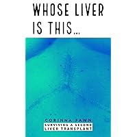 Whose Liver is This... Whose Liver is This... Kindle Paperback
