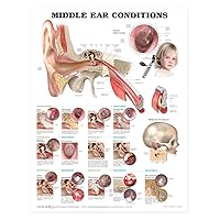 Middle Ear Conditions Anatomical Chart