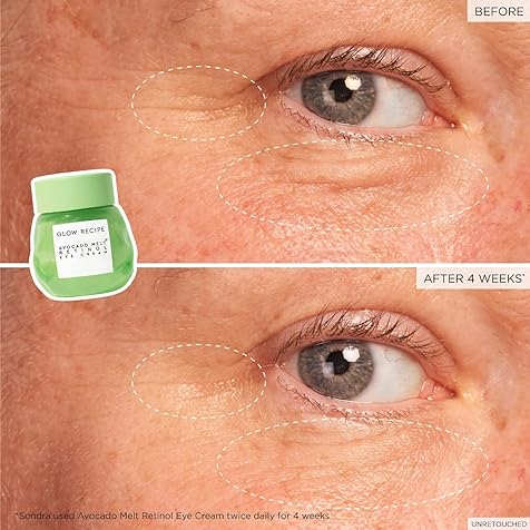 Avocado Retinol Eye Cream for Wrinkles - Overnight Under Eye Cream for Dark Circles, Firming & Brightening Dull, Puffy Eyes - Time Release Niacinamide & Caffeine Eye Cream (15ml)