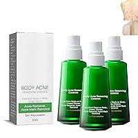 3PCS Lightenup Body Acne Serum,Whitening and Acne Removing Essence,Lighten Acne Spots and Acne Marks,Targets Body Acne & Prevents Future Breakouts