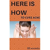 Here Is How To Cure Acne 18 Secrets