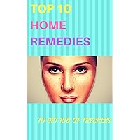 Top 10 Home Remedies To Get Rid Of Freckles