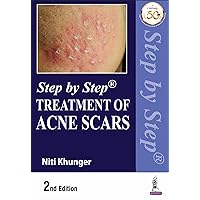 Step by Step Treatment of Acne Scars Step by Step Treatment of Acne Scars Kindle Paperback Mass Market Paperback