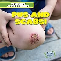 Pus and Scabs! (Your Body at Its Grossest) Pus and Scabs! (Your Body at Its Grossest) Library Binding Paperback