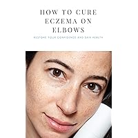 How to Cure Eczema on Elbows Easily and Fast: Eczema Cures and Tips