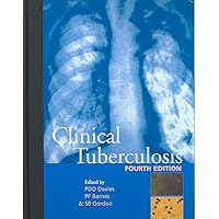 Clinical Tuberculosis (A Hodder Arnold Publication) Clinical Tuberculosis (A Hodder Arnold Publication) Hardcover