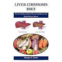 Liver Cirrhosis Diet: The New Dietary Guide To Prevent And Reverse All Kinds Of Liver Disease Liver Cirrhosis Diet: The New Dietary Guide To Prevent And Reverse All Kinds Of Liver Disease Paperback