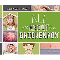 All About Chickenpox (Inside Your Body)