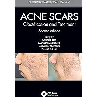 Acne Scars: Classification and Treatment, Second Edition (Series in Dermatological Treatment) Acne Scars: Classification and Treatment, Second Edition (Series in Dermatological Treatment) Kindle Hardcover