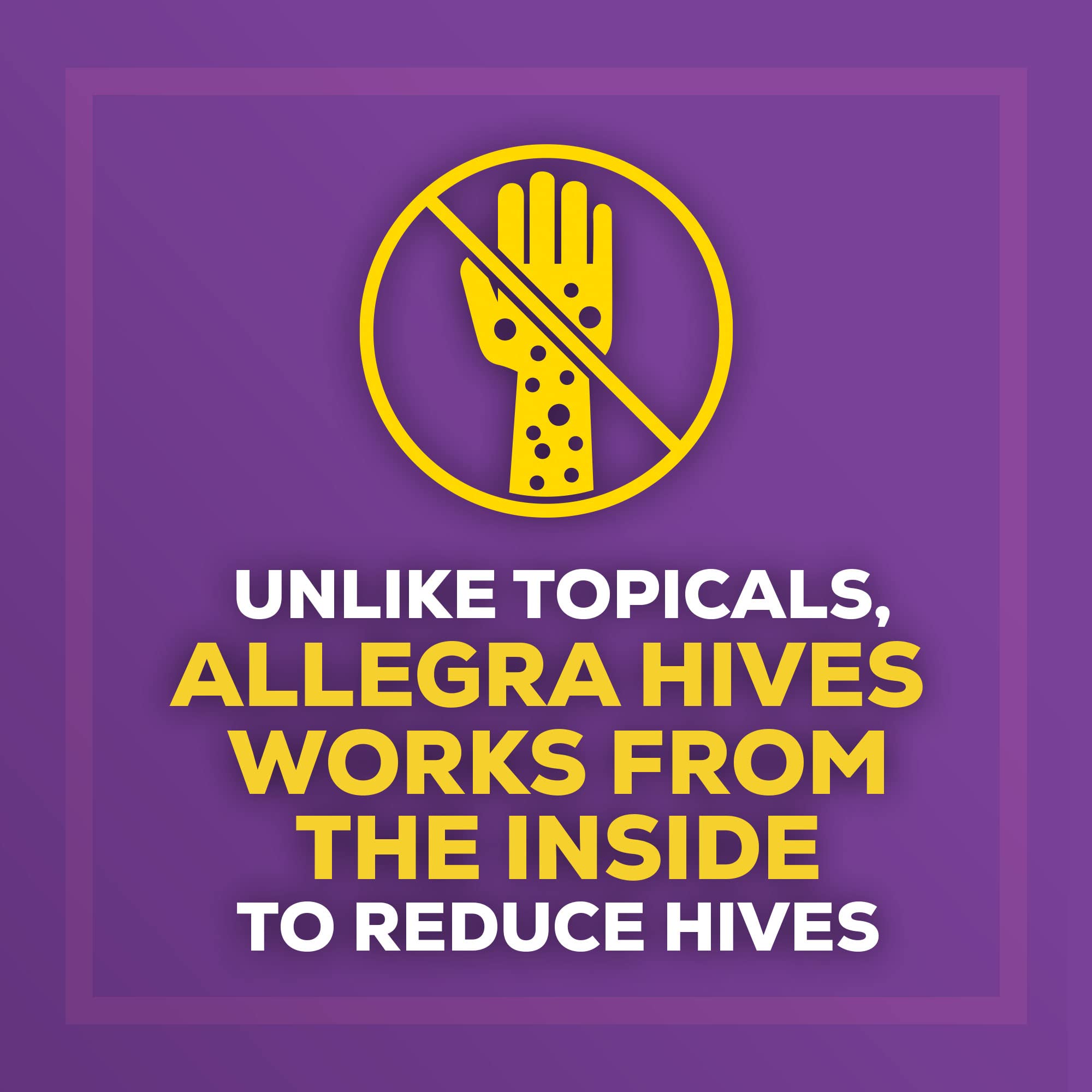 Allegra Hives Non-Drowsy Antihistamine Tablets, 30-Count, 24HR Hives Reduction & Itch Relief, 180mg