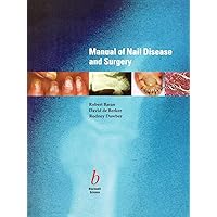 Manual of Nail Disease and Surgery Manual of Nail Disease and Surgery Paperback