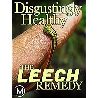 Disgustingly Healthy: The Leech Remedy