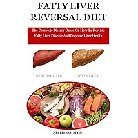 Fatty Liver Reversal Diet: The Complete Dietary Guide On How To Reverse Fatty Liver Disease And Improve Liver Health Fatty Liver Reversal Diet: The Complete Dietary Guide On How To Reverse Fatty Liver Disease And Improve Liver Health Kindle Paperback