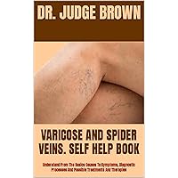 VARICOSE AND SPIDER VEINS. SELF HELP BOOK : Understand From The Basics Causes To Symptoms, Diagnostic Processes And Possible Treatments And Therapies VARICOSE AND SPIDER VEINS. SELF HELP BOOK : Understand From The Basics Causes To Symptoms, Diagnostic Processes And Possible Treatments And Therapies Kindle Paperback