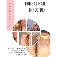 FUNGAL NAIL INFECTION: GUIDE FOR TAKING CARE OF YOUR NAIL TO PREVENT INFECTION FUNGAL NAIL INFECTION: GUIDE FOR TAKING CARE OF YOUR NAIL TO PREVENT INFECTION Kindle Paperback