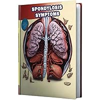 Spondylosis Symptoms: Explore the symptoms of spondylosis, a degenerative condition affecting the spine's vertebrae and discs. Spondylosis Symptoms: Explore the symptoms of spondylosis, a degenerative condition affecting the spine's vertebrae and discs. Paperback