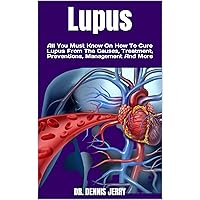 Lupus : All You Must Know On How To Cure Lupus From The Causes, Treatment, Preventions, Management And More Lupus : All You Must Know On How To Cure Lupus From The Causes, Treatment, Preventions, Management And More Kindle