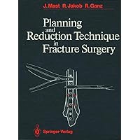 Planning and Reduction Technique in Fracture Surgery Planning and Reduction Technique in Fracture Surgery Hardcover Paperback