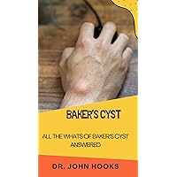 BAKER’S CYST: ALL THE WHATS OF BAKER’S CYST ANSWERED