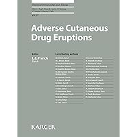 Adverse Cutaneous Drug Eruptions (Chemical Immunology and Allergy Book 97) Adverse Cutaneous Drug Eruptions (Chemical Immunology and Allergy Book 97) Kindle Hardcover