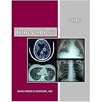 Tuberculosis 2017: English Edition Tuberculosis 2017: English Edition Kindle Paperback