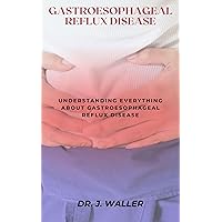 GASTROESOPHAGEAL REFLUX DISEASE: UNDERSTANDING EVERYTHING ABOUT GASTROESOPHAGEAL REFLUX DISEASE GASTROESOPHAGEAL REFLUX DISEASE: UNDERSTANDING EVERYTHING ABOUT GASTROESOPHAGEAL REFLUX DISEASE Kindle Paperback