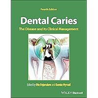 Dental Caries: The Disease and its Clinical Management