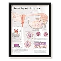 Female Reproductive System Framed Medical Educational Informational Poster Diagram Doctors Office School Classroom 22x28 Inches