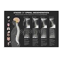 XIAOHUANG Spinal Degeneration Clinic, Hospital Wall Decoration Poster (4) Canvas Poster Bedroom Decor Office Room Decor Gift Unframe-style 24x16inch(60x40cm)