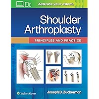 Shoulder Arthroplasty: Principles and Practice Shoulder Arthroplasty: Principles and Practice Hardcover Kindle