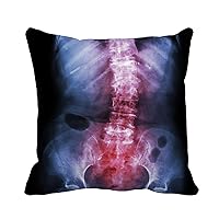 Throw Pillow Cover Spondylosis and Scoliosis Film X Ray Lumbar Sacrum Spine 16x16 Inches Pillowcase Home Decorative Square Pillow Case Cushion Cover