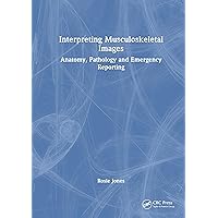 Interpreting Musculoskeletal Images: Anatomy, Pathology and Emergency Reporting Interpreting Musculoskeletal Images: Anatomy, Pathology and Emergency Reporting Kindle Hardcover Paperback