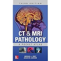 CT & MRI Pathology: A Pocket Atlas, Third Edition CT & MRI Pathology: A Pocket Atlas, Third Edition Paperback Kindle