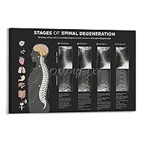 Spinal Degeneration Level Chart Demonstration Chart Spinal Subluxation Art Poster (3) Canvas Poster Bedroom Decor Office Room Decor Gift Frame-style 24x16inch(60x40cm)