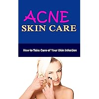 Acne Skin Care: How to Take Care of Your Skin Infection