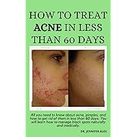 HOW TO TREAT ACNE IN LESS THAN 60 DAYS: All you need to know about acne, pimples and how to get rid of it in less than 60 days. You will learn how to manage black spot natural and medically. HOW TO TREAT ACNE IN LESS THAN 60 DAYS: All you need to know about acne, pimples and how to get rid of it in less than 60 days. You will learn how to manage black spot natural and medically. Kindle Paperback