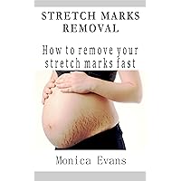 STRETCH MARKS REMOVAL: Natural Home Remedies To Remove Stretch Marks Fast For Pregnancy Mom Fat Body STRETCH MARKS REMOVAL: Natural Home Remedies To Remove Stretch Marks Fast For Pregnancy Mom Fat Body Kindle Paperback