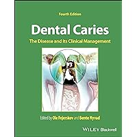 Dental Caries: The Disease and its Clinical Management