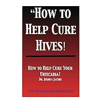 How to Help Cure Hives How to Help Cure Hives Kindle Paperback