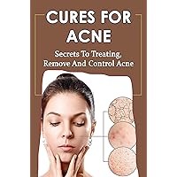 Cures For Acne: Secrets To Treating, Remove And Control Acne