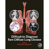 Difficult to Diagnose Rare Diffuse Lung Disease Difficult to Diagnose Rare Diffuse Lung Disease Kindle Paperback