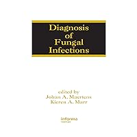 Diagnosis of Fungal Infections (Infectious Disease and Therapy Book 47) Diagnosis of Fungal Infections (Infectious Disease and Therapy Book 47) Kindle Hardcover Paperback