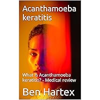 Acanthamoeba keratitis: What is Acanthamoeba keratitis? - Medical review