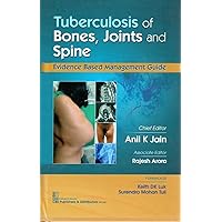 Tuberculosis of Bones, Joints and Spine Evidence Based Management Guide Tuberculosis of Bones, Joints and Spine Evidence Based Management Guide Kindle Paperback