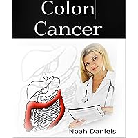 Colon Cancer Colon Cancer Kindle